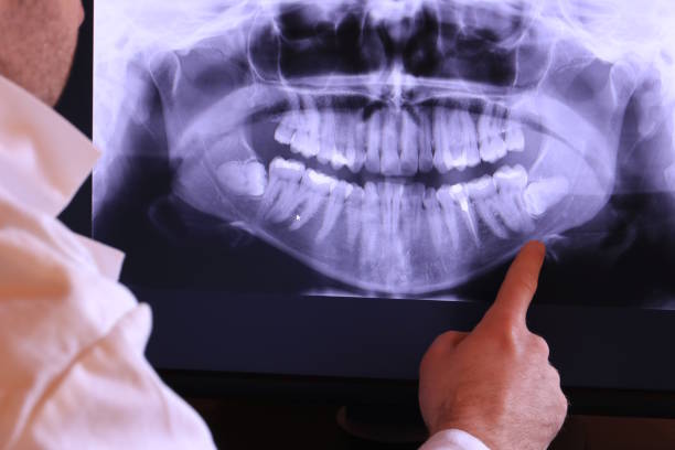 Best Emergency Tooth Extraction in Ocean Springs, MS
